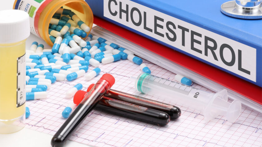 Équilibrer le cholestérol : approches alimentaires et de style de vie